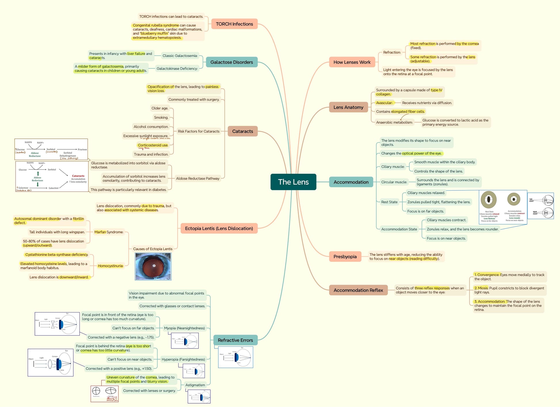 Mastermaps Ophthalmology