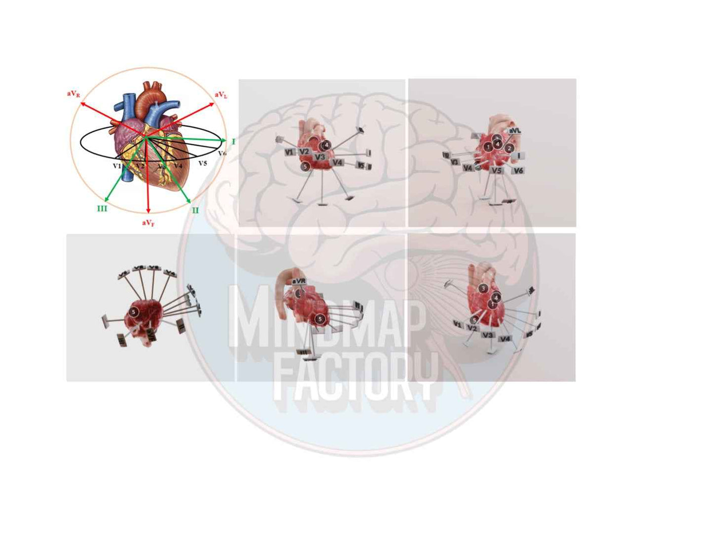ECG Decoded: A Pattern-Based Approach