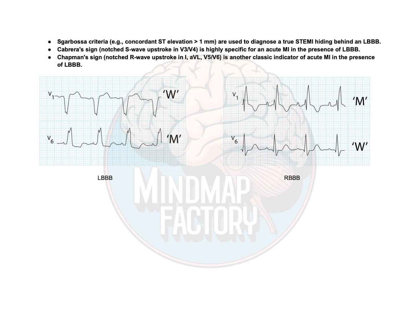 ECG Decoded: A Pattern-Based Approach
