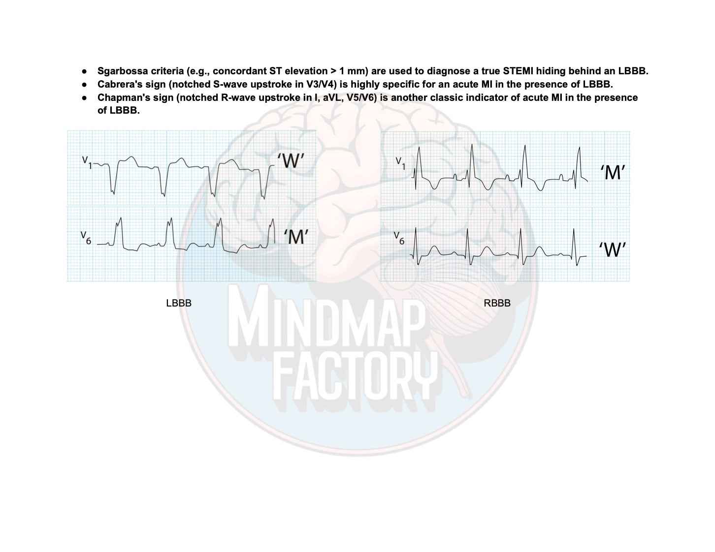 ECG Decoded: A Pattern-Based Approach