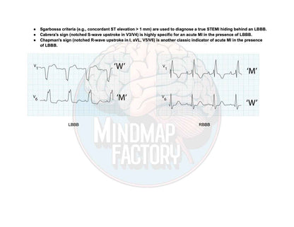 ECG Decoded: A Pattern-Based Approach
