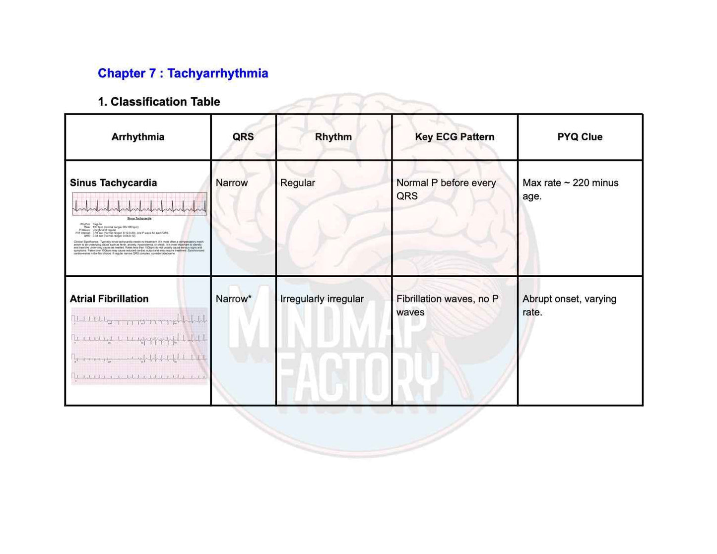 ECG Decoded: A Pattern-Based Approach