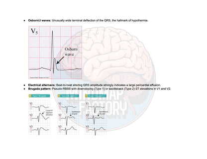 ECG Decoded: A Pattern-Based Approach