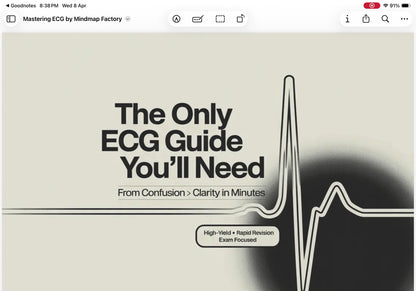 ECG Decoded: A Pattern-Based Approach
